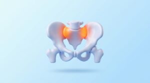 허리 아픈데 디스크는 아닐 때? 천장관절 증후군