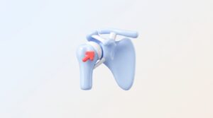 어깨 통증의 주범, 어깨 충돌 증후군 증상과 치료