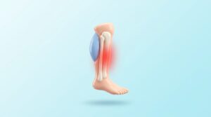 런닝족 정강이 통증, 신스플린트! 증상과 효과적인 관리법