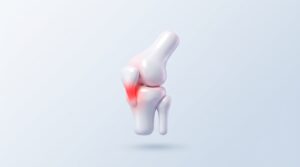 성장기 무릎 통증: 오스굿 슐라터병 이해와 관리